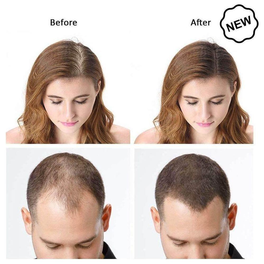 Dexe Hair Building Fibers 22g - gtwtoporld.com