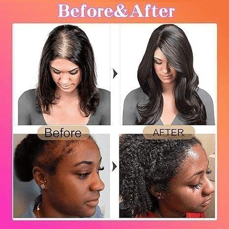 100% Batana Oil Conditioner 120ml - gtwtoporld.com