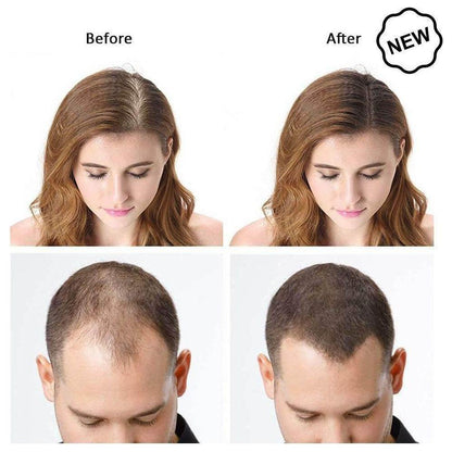 Dexe Hair Building Fibers 22g - gtwtoporld.com