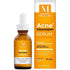 Mados Acne Treatment Serum 30ml - gtwtoporld.com