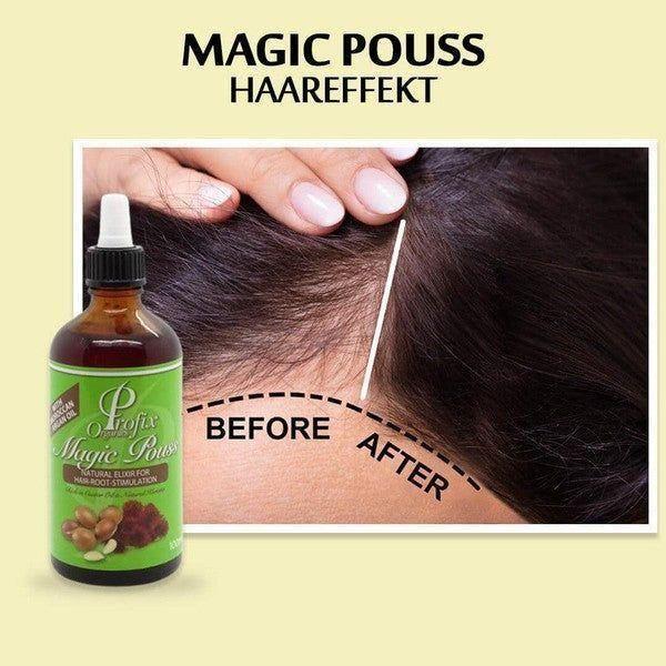 Profix Magic Pouss Natural Elixir for Hair - Root - Stimulation 100ml - gtwtoporld.com