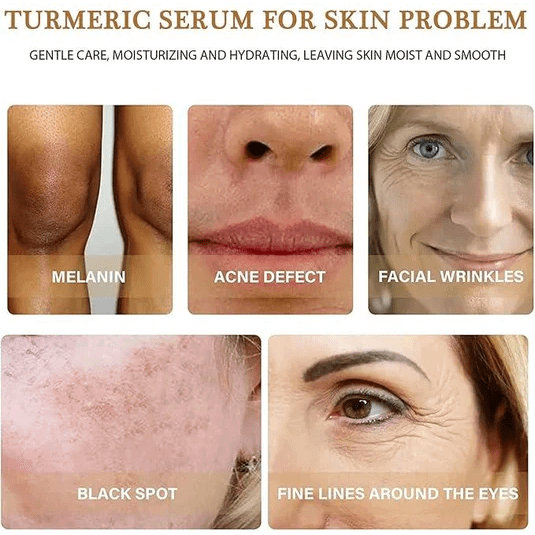 Turmeric Oil Serum 100% Pure &amp; Natural 30ml - gtwtoporld.com